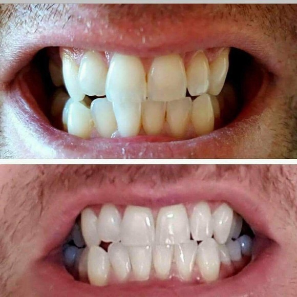 Whitening Toothpaste!! - Picture 5 of 6